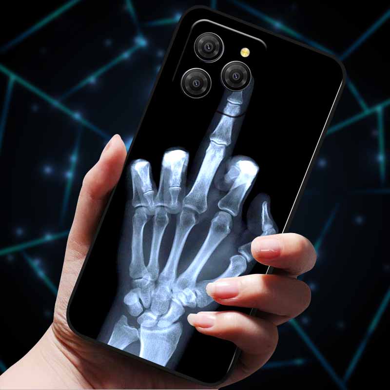 For Blackview Shark 9 5G Case Shark9 Luxury Fashion Silicon Shockproof Phone Back Cover For Blackview Shark 9 Cases Shell Capas