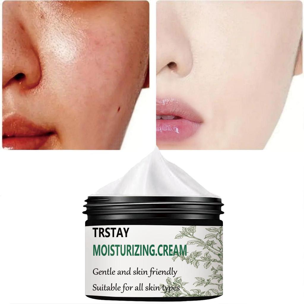 Gentle and Non-irritating, the Translucent and Blemish Moisturizing Cream Tightens the Skin, Brightens the Complexion