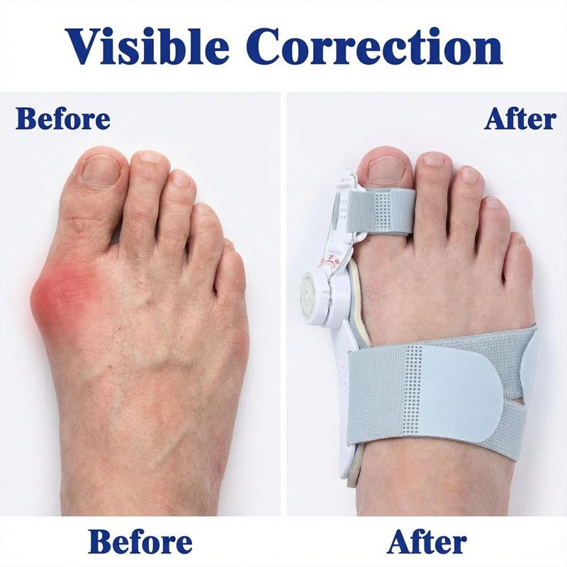 

Ортопедический бандаж для большого пальца стопы при вальгусной деформации - Дышащий регулируемый ремень-корректор для выравнивания пальцев и защиты суставов