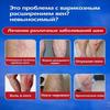 Vein Health Patch, Remove Leg Pain And Swelling Varicose Blood Vessels Earthworm Leg Vein Health Patch