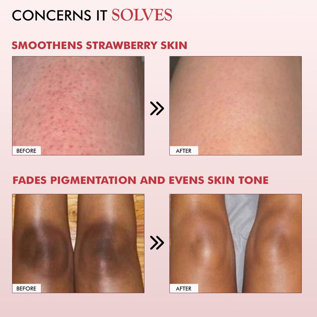 mCaffeine 11% AHA BHA Strawberry Body Lotion 200ml for Smooth Skin, Hydration & Juicy Fragrance, Men & Women