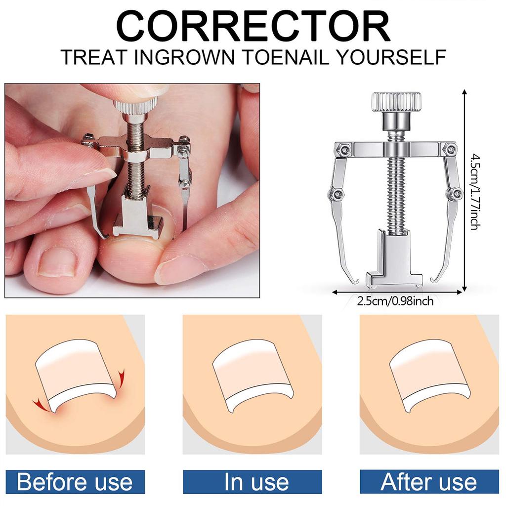 10Pcs Ingrown Toenail Clippers Kit Stainless Steel Ingrown Toenail Removal Kit Toenail Clippers Set for Ingrown and Thick Nail