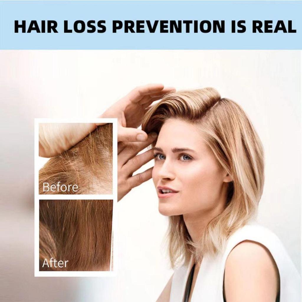 Die Anti-Haarausfall-Creme dringt tief in das Haar ein und repariert beschädigte Haarkerne und sorgt so für gesundes und kräftiges Haar.