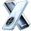 Case + 2 Tempered Glasses for Honor Magic 7 Pro, Shockproof Slim Silicone Reinforced Corners Transparent