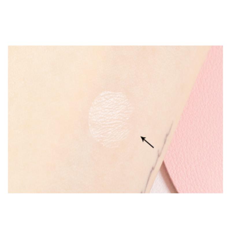 Franz Naked Spot Patch 72 Patches | Invisible Hydrocolloid Acne Patch