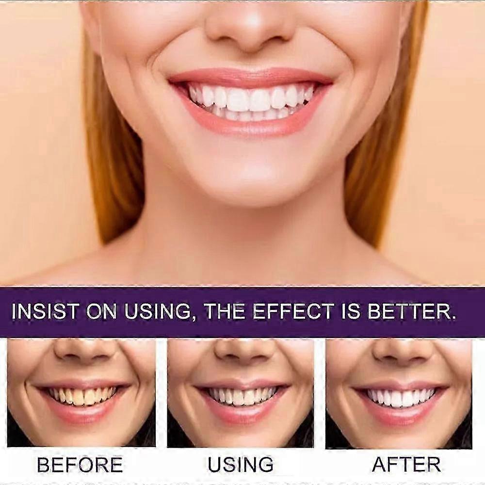 7 Pro Strong Whitening Toothpaste, Intense Whitening Toothpaste 7 Pro
