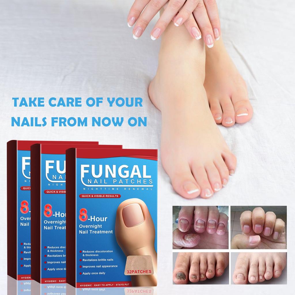 Adesivos para cuidados noturnos com as unhas Adesivos para cuidados com as unhas Cuidados com as unhas Unhas espessas Unhas encravadas e unhas moles Adesivos para cuidados com as unhas