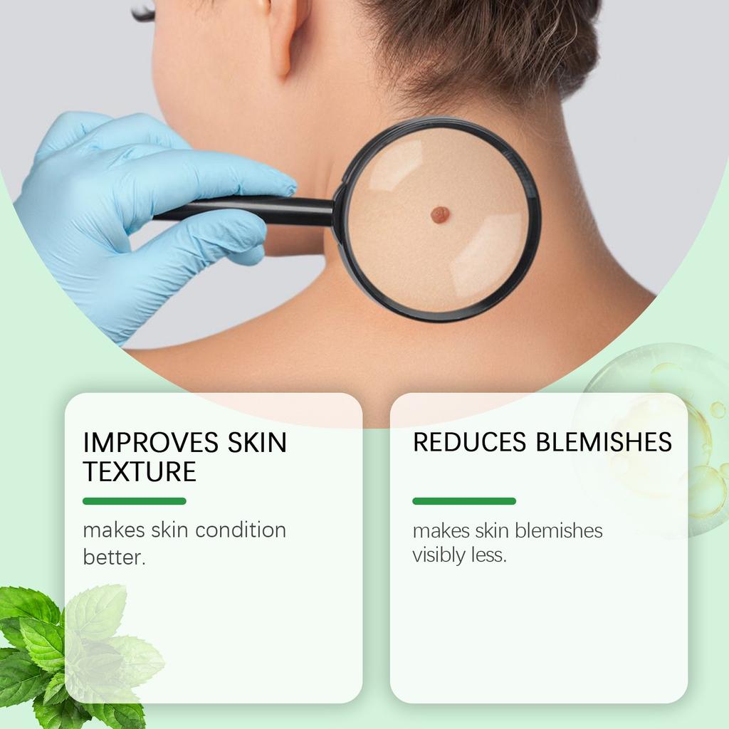 Kräuter-Gelee-Gel, Entfernungsgel, Gel zur Reduzierung von Hautunreinheiten, Pflegegel für ungleichmäßigen Hautton, 50 g