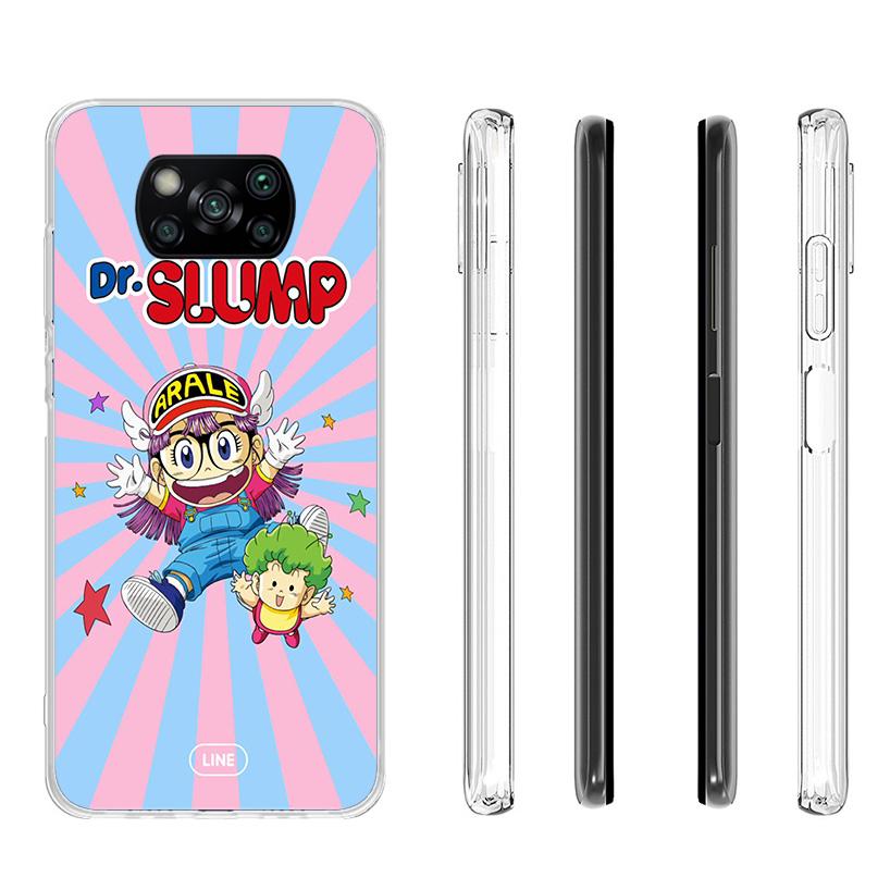 Dr Slump Arale Anime Phone Case For Xiaomi Poco X7 X6 X5 Pro F7 Ultra Redmi 15C 15 13C 13 12C 12 10 10A 10C 9 9A 9C 9T Cover Poc
