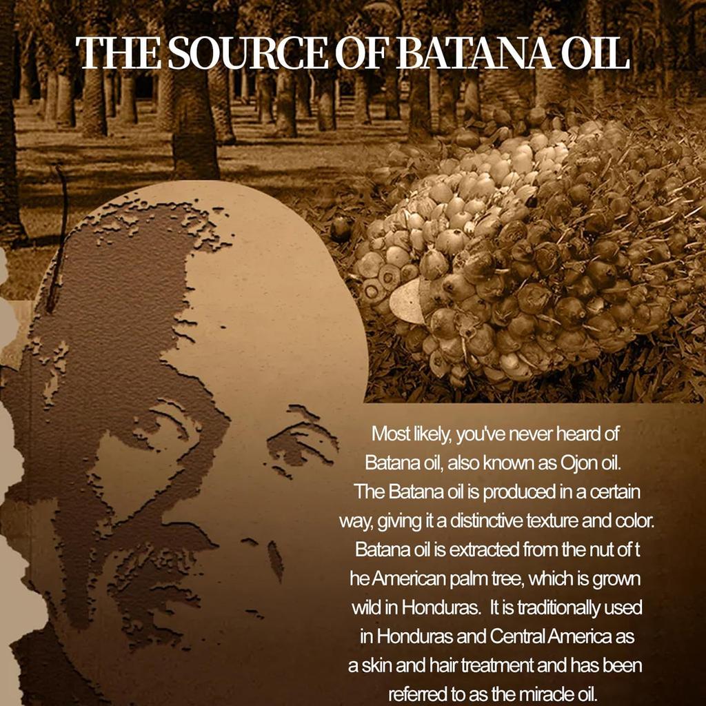 Aceite de Batana de Botanix para el crecimiento del cabello, aceite de Batana natural para el crecimiento del cabello de Botanix, aceite de Batana sin refinar, para hombres y mujeres