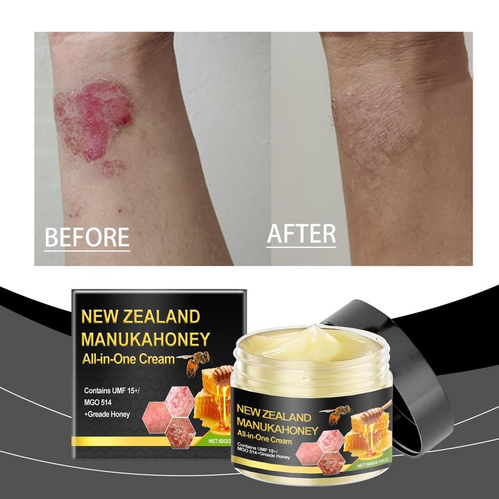 Bee Venoms Skin Care Cream Soothes Redness Gentle Nourishing Skin Care Cream