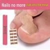 Ortopedická náplast na korekci zarostlého nehtu bez lepidla pro Lala Manicure