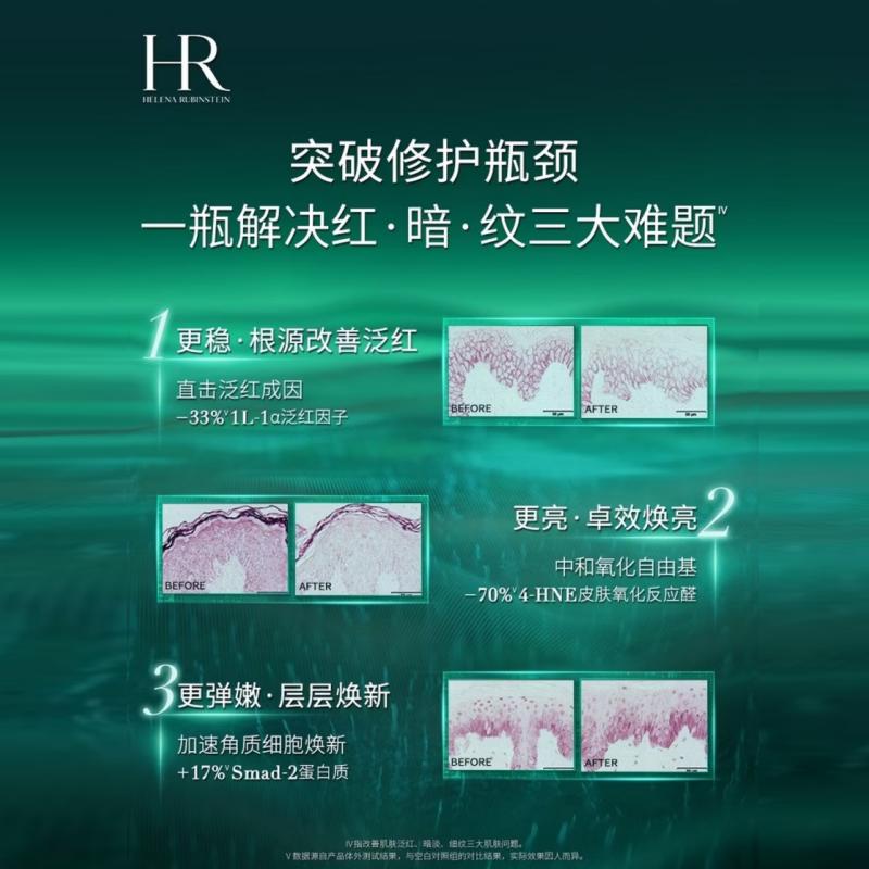 Helena HR New Edition Green Bottle Yuehuo Essence imited Gift Box Anti-acne Soothing Moisturizing Repair Exfoliating Oil Control // 50ml