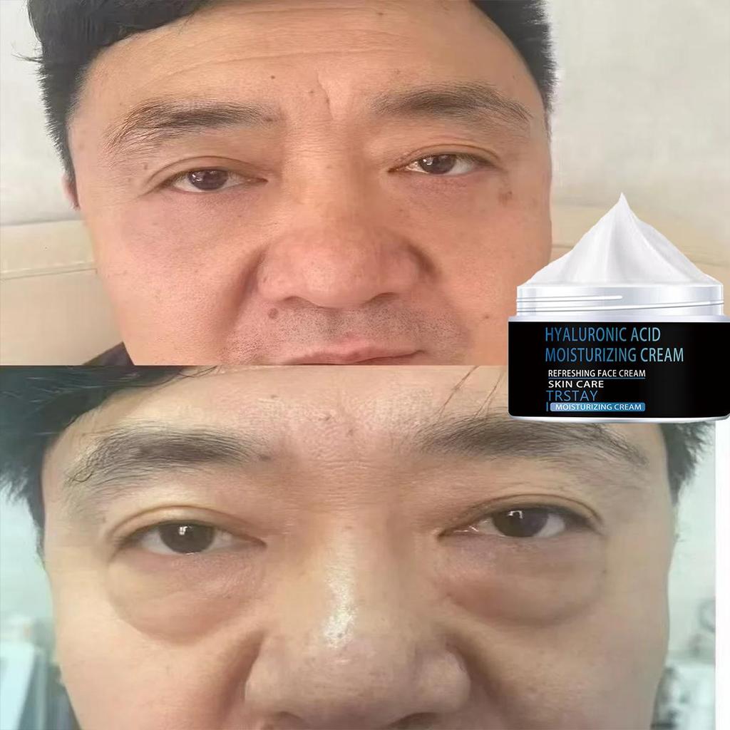 Pánský retinolový krém je jemný a nedráždivý, vyhlazuje vrásky, snižuje výskyt jemných linek a zanechává pokožku jemnou a jemnou.