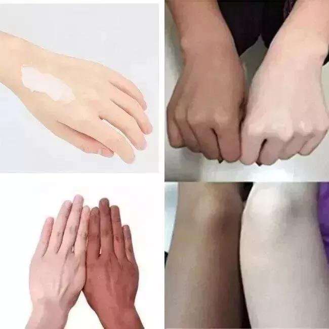 Kojic Acid Cream 50 ml (Pack of 5) | Instant Wrinkle Cream Eye Firming Anti-Aging Lifting Moisturizing Cream | For All Skin Types