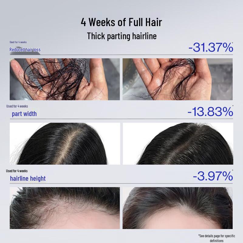 EHD Anti-Hair Loss & Oil Control Hair Essence Roller Ball