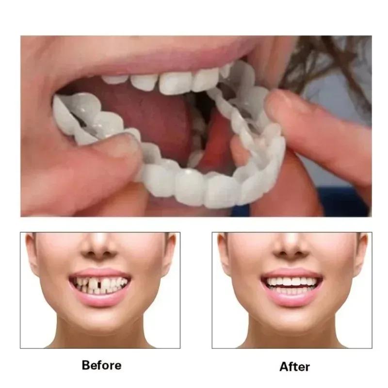 15pairs Perfect Fit Teeth Whitening Fake Tooth Cover Snap on Silicone Smile Veneers Teeth Flexibles Fake Teeth Dental Whitening