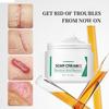 1PC After Burn Fading Skin Ointment