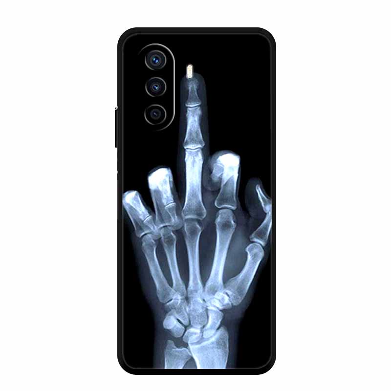 Case For Tecno Pova 3 Animals Silicone Soft TPU Back Cover For Tecno Pova 3 Pova3 LF7n Phone Cases TecnoPova 3 Shockproof Coque