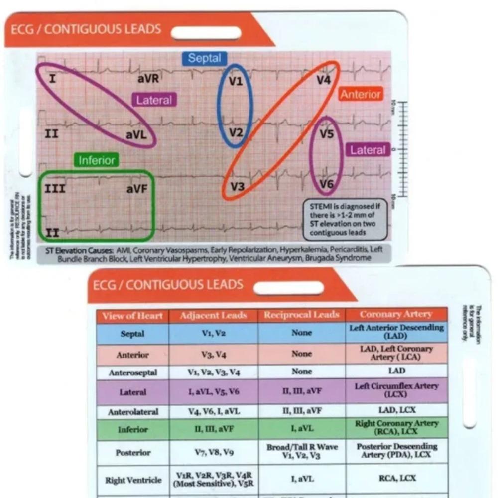 Precision Measurement Ecg/ekg Rhythm Pocket Card Measuring EKG Caliper  Household Tool