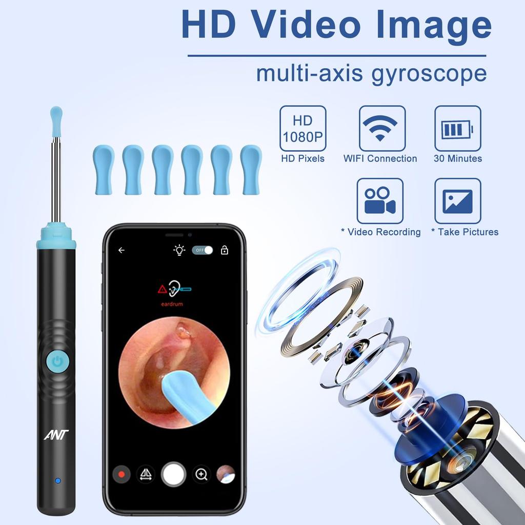 ANT Smart Ear Wax Removal Tool, Wireless Ear Cleaner with HD Camera, LED Lights, IP67 Waterproof Lens, WiFi Otoscope, Rechargeable, Android & iOS