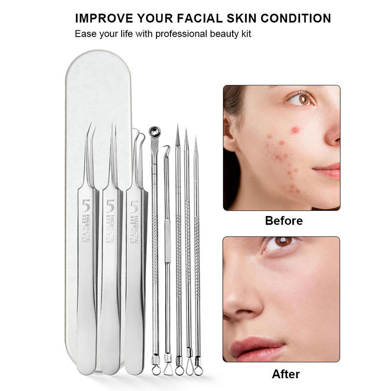 Acne Blackhead Removal Needles Kit Black Spot Blemish Pimple Removal Needle Deep Cleansing Tool Face Skin Care Stainless Steel