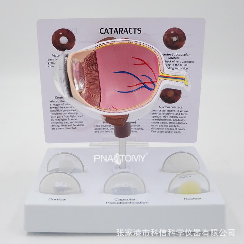Magnified Human Eye Anatomy Model for Ophthalmology Teaching and Display PNT-0730