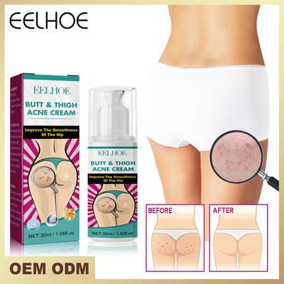 Crème anti-acné des hanches et des cuisses, pour éclaircir les soins de la peau, nettoyage et élimination de l'acné, Massage corporel pour hydrater et raffermir