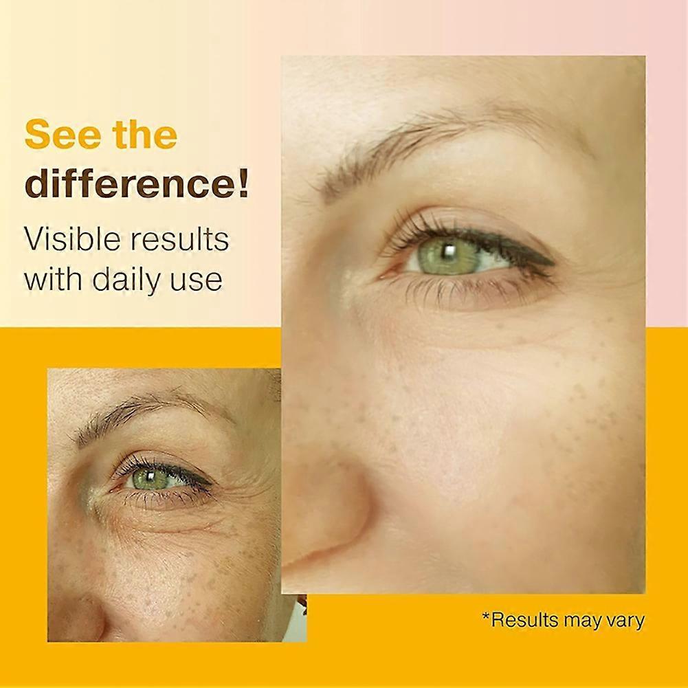 Vita C VE Facial Serum 30ml Anti-Aging Skin Revitalizing Essence Anti-Wrinkle Dark Spots Removal