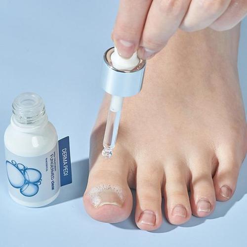 [Bandi] Derma Pedi Fungeumed Clear 15ml