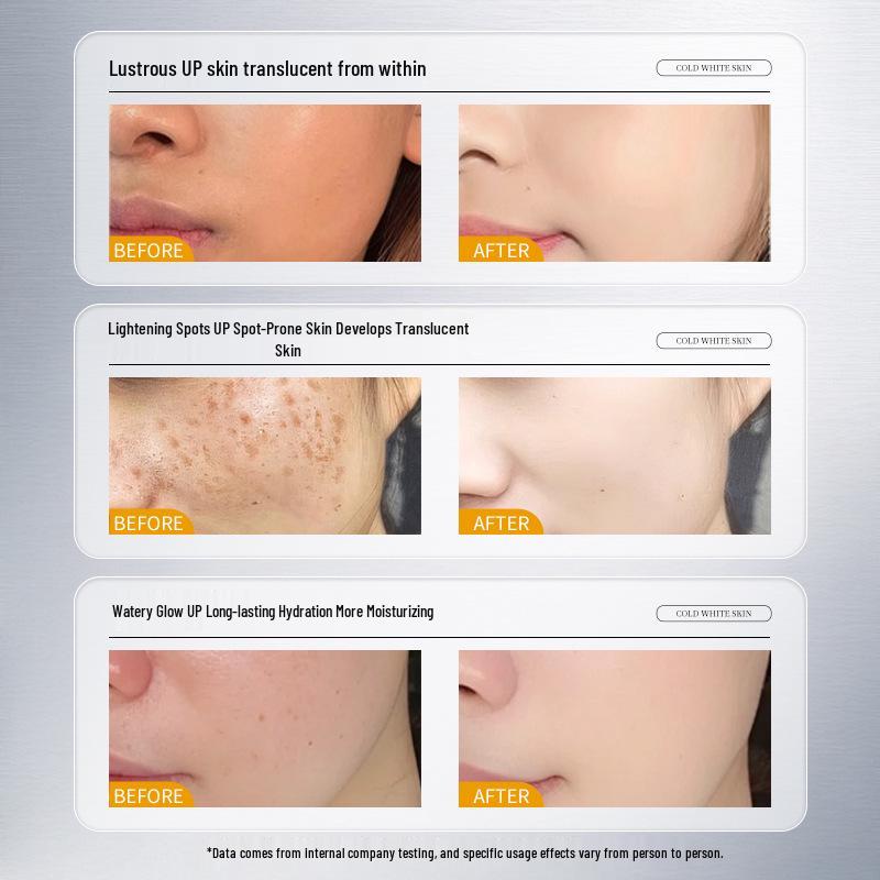 Han Ji 377 Niacinamid Aufhellende Essenz zur Aufhellung, Entfernung von Sommersprossen, Feuchtigkeitsversorgung und Aufhellung von Flecken.