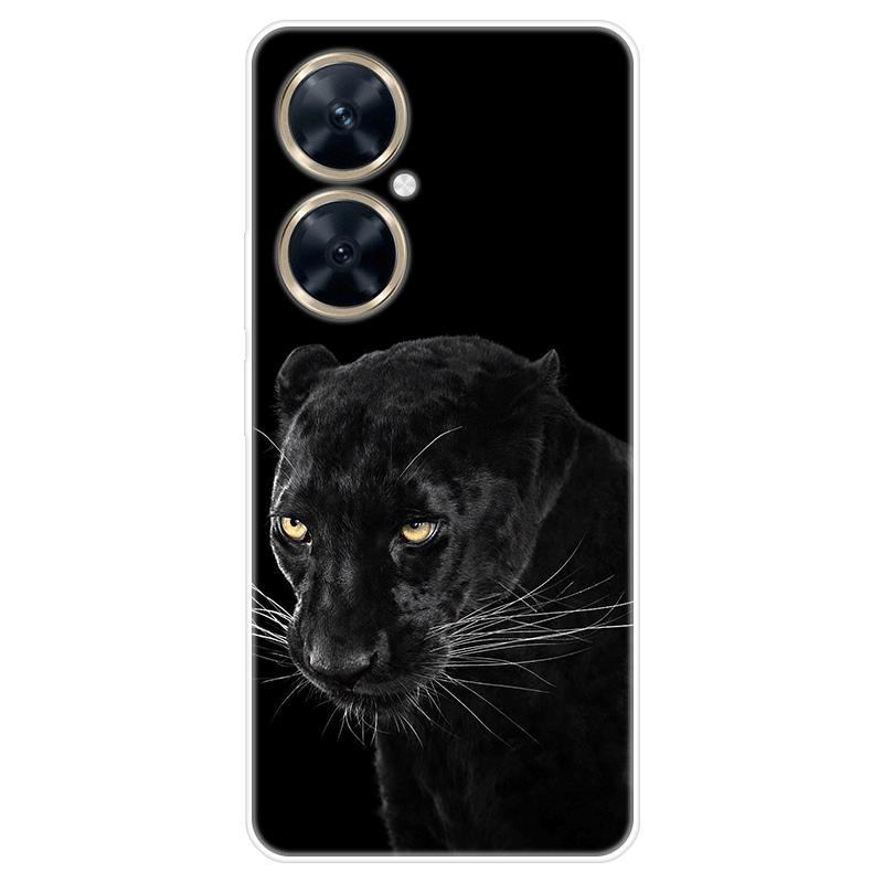 Für Huawei nova 11i nova11i Fall Weiche Silikon Zurück Abdeckung Cartoon Telefon Fall Diversifizierung