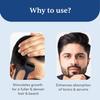 Man Matters Advanced Derma Roller 0,5 mm Titan-Nadeln zur Stimulierung des Bart- und Haarwuchses, Sicher und Einfach zu Bedienen