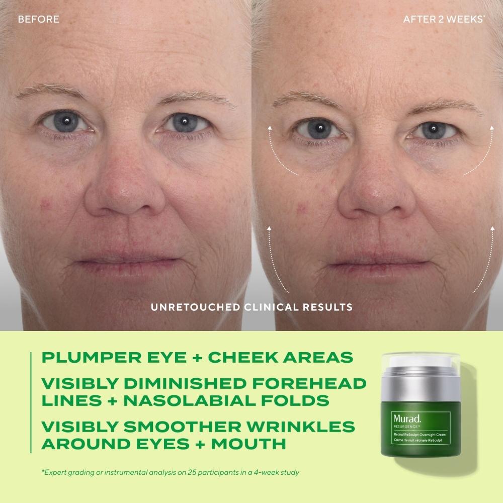 Murad Retinal Resculpt Overnight Cream 1.7 Oz 50 Ml