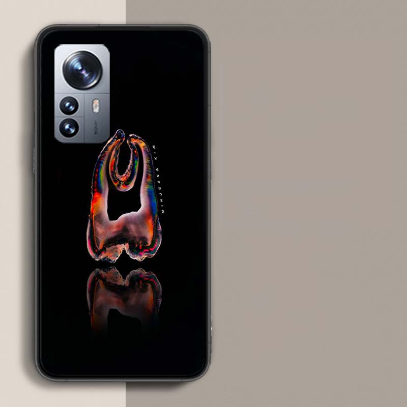 Dentist Tooth Pattern Phone Case For Xiaomi Poco X3 NFC X4 GT M3 M4 M5 M5S X7 X6 X5 F6 Pro F5 F4 Mi F3 F2 Cover TPU Capa Coque C