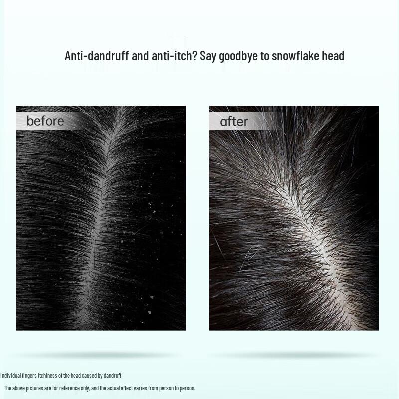 ZIYUAN Tea Seed Oil Control Anti-Dandruff Shampoo