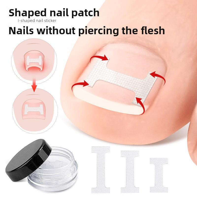I-shaped Inlaid Nail Positive Nail Sticker Physical Stretching Patch Pull Nail Groove Curl Nail Small Invisible Shoes Can Walk