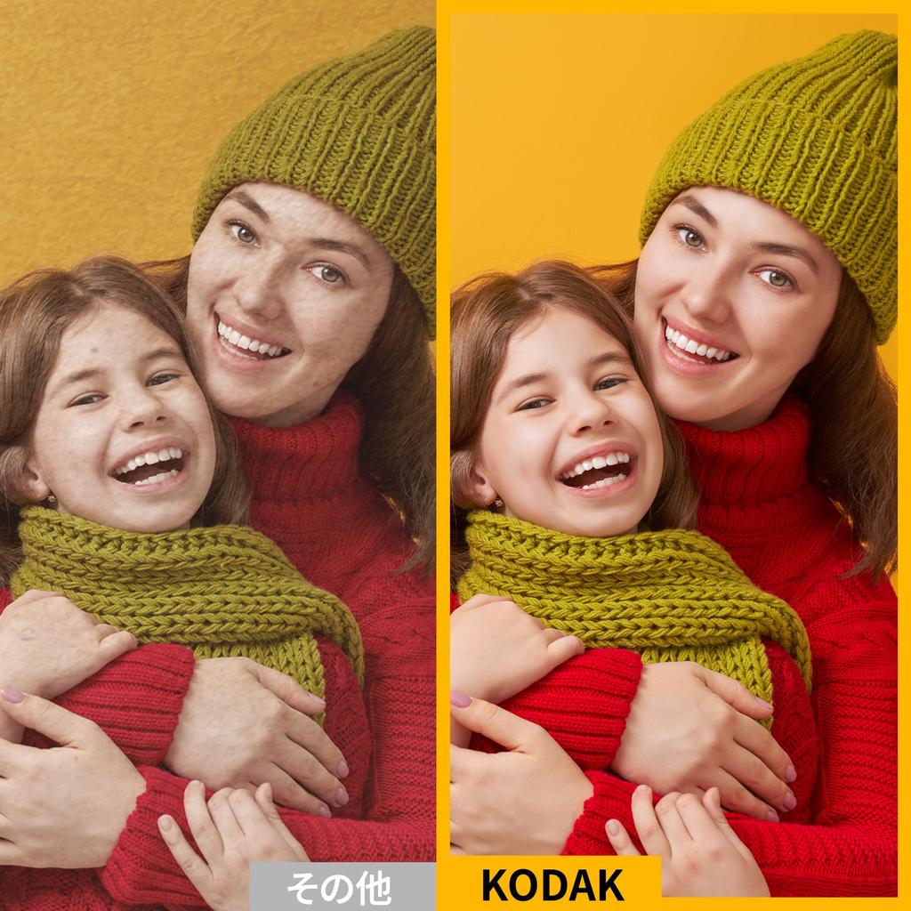 Kodak Mini 2 Retro 4-Pass Smartphone Printer/Instant Printer/Instax Printer (5.3 X 8.6 Cm) + 8-Printer + 30-Print Accessory Bundle, White