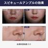 TOSOWOONG Real Spicule Ampoule Pure Spicule Collagen Needle Serum for Sensitive Korean Skincare Cosmetics 30ml, Bio-Needle Firming, Exfoliating,
