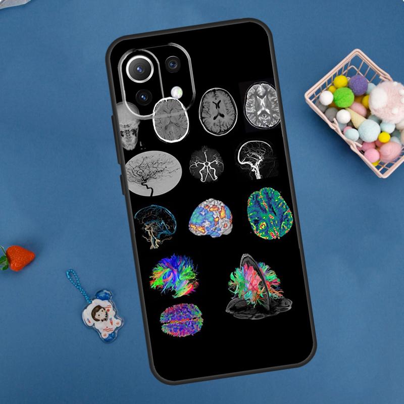 

Anatomy Brain Case For Xiaomi 14 13 15 Ultra 11T 12T 13T 14T Pro POCO X7 Pro X3 X5 F5 F6 M6 X6 Pro Cover POCO X3 Pro