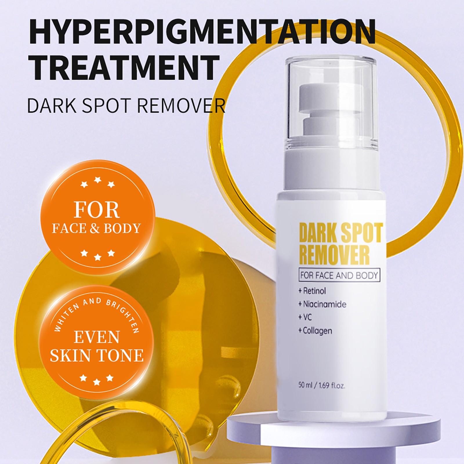

Dark-Spot Remover Cream Lightens Spots And Brightens Skin Tone 50ml One Size