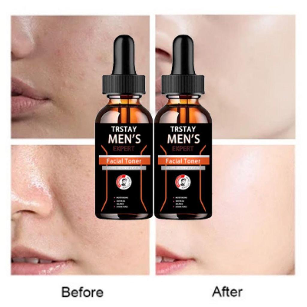 Facial Moisturizing Collagen Cream - Moisturizing,Containing Retinol And Hyaluronic Acid Can Promote Skin Renewal And Reduce Wrinkles And Fine Lines