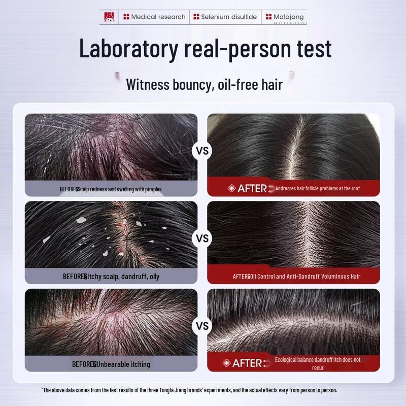 Three Magicians Selenium Disulfide Anti-Dandruff Shampoo