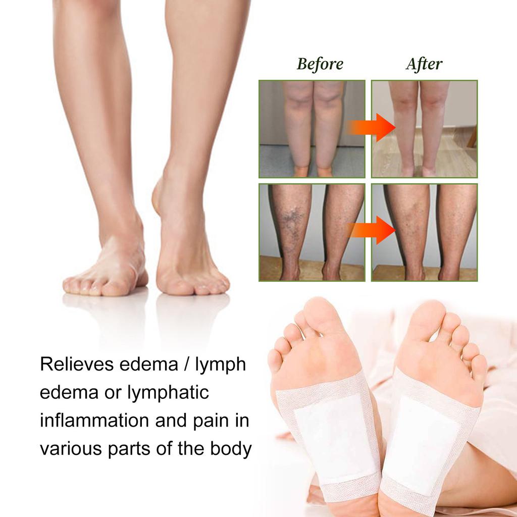 South Moon Foot Patches For Vein Care Effective Body Treatment Relief From Swelling And Discomfort