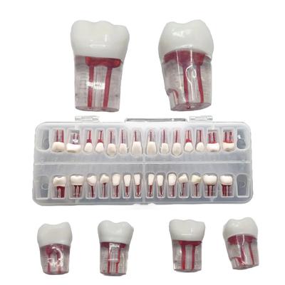 1set Dental Root Canal Resin Practice Model 28 Teeth Endodontic Study Model Pulp Cavity Demonstration Teaching Tool Training Kit