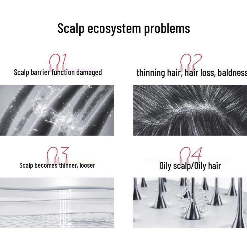 Shu Lei Anti-Hair Loss & Oil Control Shampoo