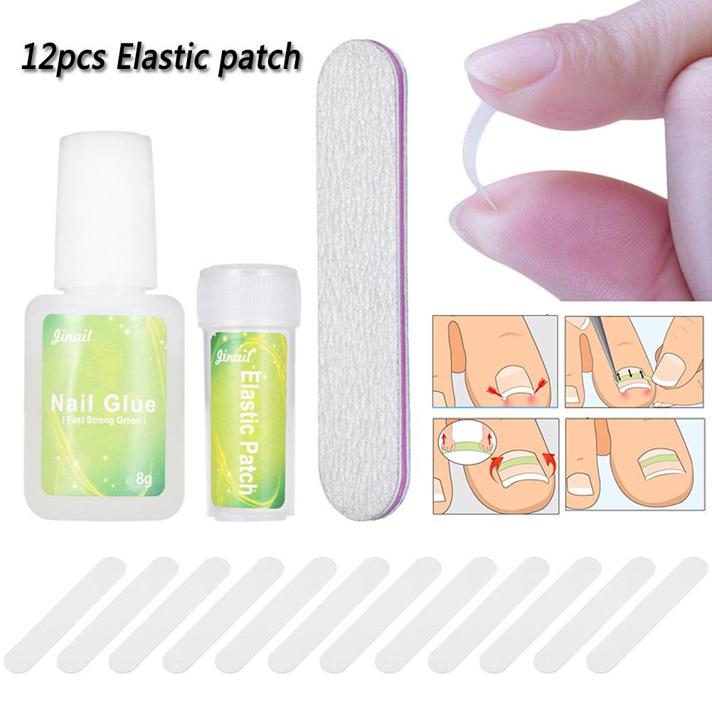 Clinging 12Pcs Ingrown Toenail Correction Pedicure Tool Elastic Patch Straightening Clip