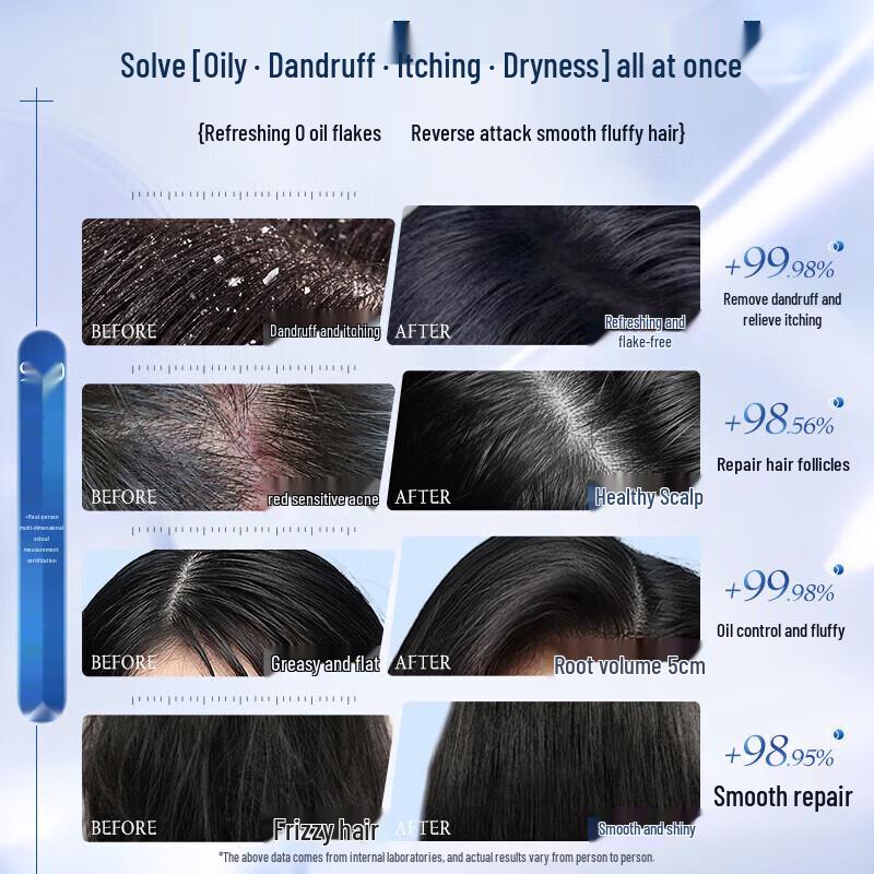 Selenium Sulfide Anti-Dandruff & Oil Control Shampoo
