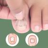Nail Correction Wire, Ingrown Nail Correction Device, Nail Clipping, Ingrown Nail Correction Wire, Toenail Correction Hook