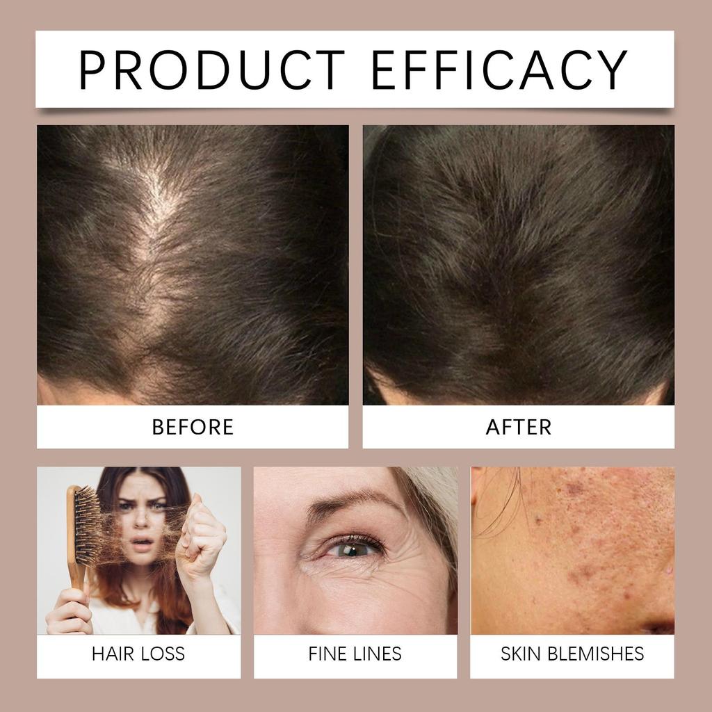 WoodSleep Castor Oil 100ml: Deep Hydration + Follicle Repair! Natural Formula, Suitable for Face/Body/Eyebrows & Eyelashes